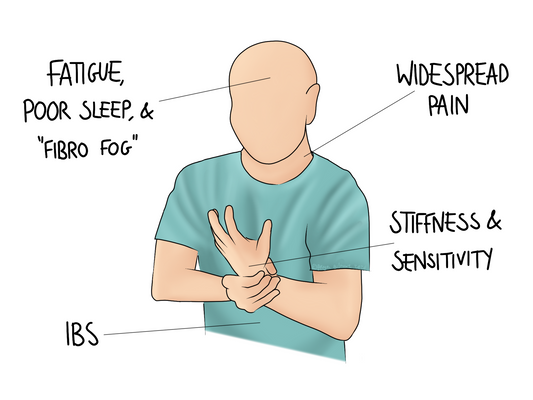 What it's like living with Fibromyalgia
